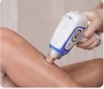 Laser Hair Reduction
